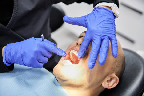 Best Emergency Tooth Extraction in Jesup, IA