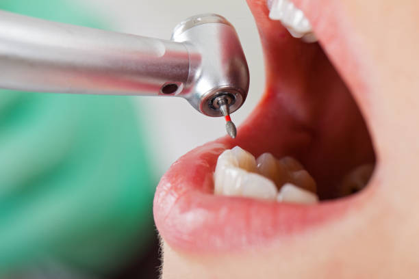 Best Cosmetic Emergency Dentistry in Jesup, IA